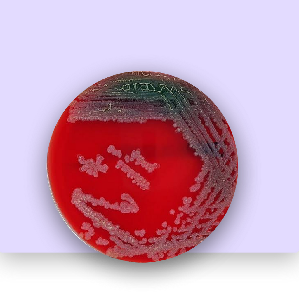 bacillus licheniformis